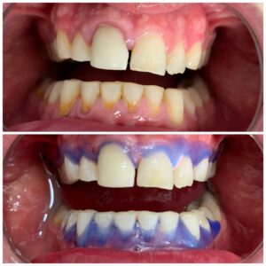 dental treatments istanbul1