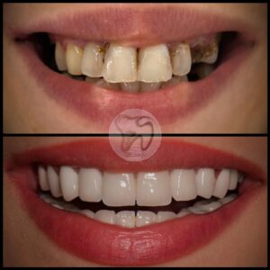 dental treatments istanbul7