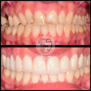 dental treatments istanbul5