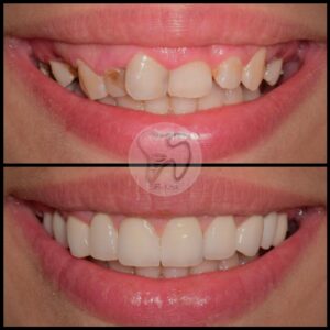 dental treatments istanbul6