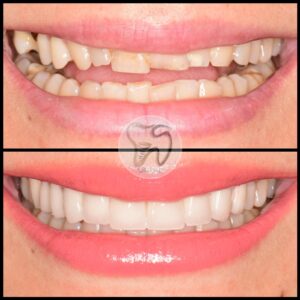 dental treatments istanbul3