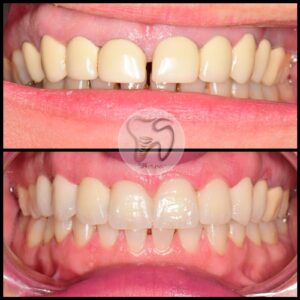 dental treatments istanbul2