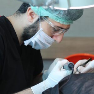 hair transplant in istanbul
