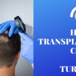 turkey hair transplant cost